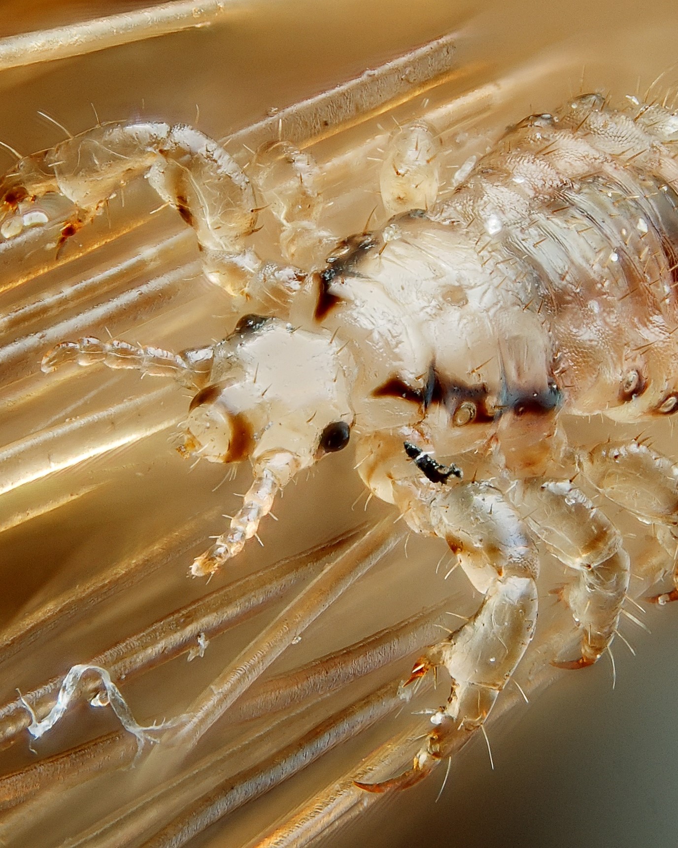 male-human-head-louse-1