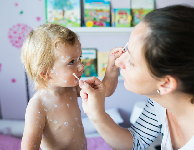 toddler eczema cream_sum.jpg